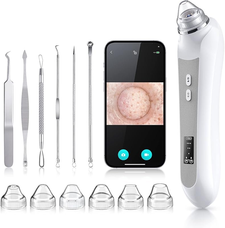 USB Blackhead Remover Vacuum with Camera: 6 Suction Heads and 3 Adjust